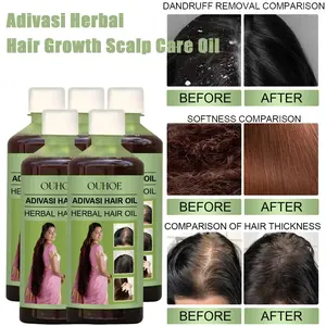100ML Hair Growth Oil, India Adivasi Herbal Hair Care, Rosemary Repair, Hydrate & Moisturize Scalp, Reduce Dandruff, Rosemary Oil For Hair Growth, Scalp Stimulating Oil, Scalp Stimulator