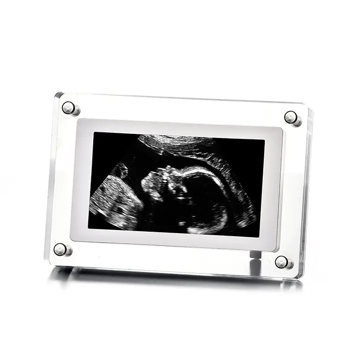 Digital Video Frames Digital Video Frames