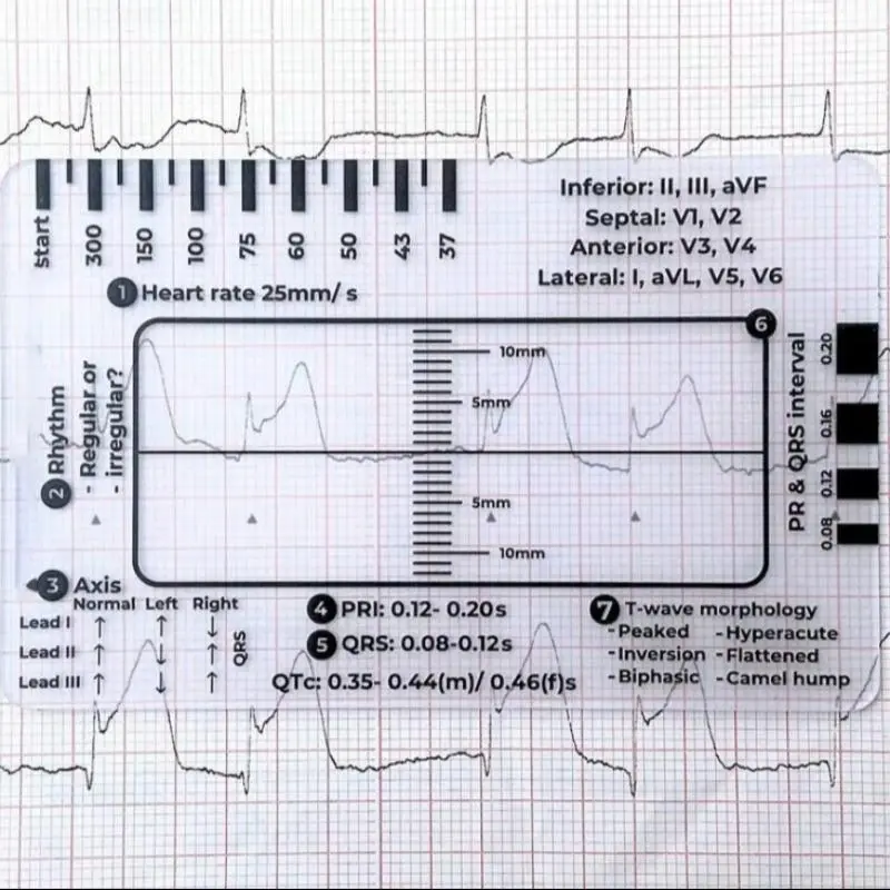 Ecg Ruler, 1 Count Heart Rate Monitoring Tool Portable Lightweight Suitable for Students Nurses Doctors, OfficeStationery & Supplies