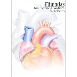 USED-Insuficiencia Cardiaca y Diabetes (Spanish Edition) by LEPORE, LUIS (Paperback)