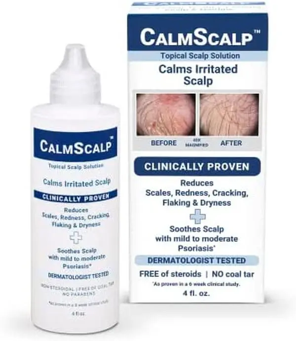 Scalp Solution | Calms Irritated, Itchy Scalp | Dry Scalp Treatment | Reduces Scales, Flakes & Redness | Clinically Proven | Start Seeing Results in 1 week | 4 oz