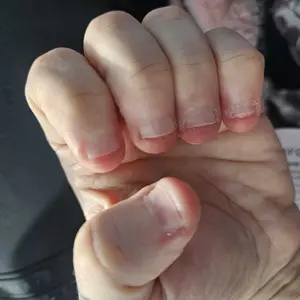 Product Review of Radiant Cosmetics Nail Growth Oil - 100% Organic, Moisturizing, Growth, Strengthening, and Brightening Formula with Vitamins and Fatty Acids for Overall Nail Health from u**6