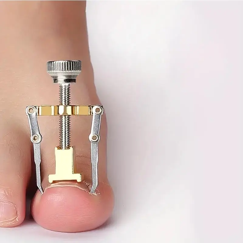 Ingrown Toenail Lifter, Ingrown Toenail Corrector, Softens and Trims Nails Easily, Lightweight Pedicure Tool for Recovery, Christmas Gift, Nail Care, Nail Care Metal, Nail Tools