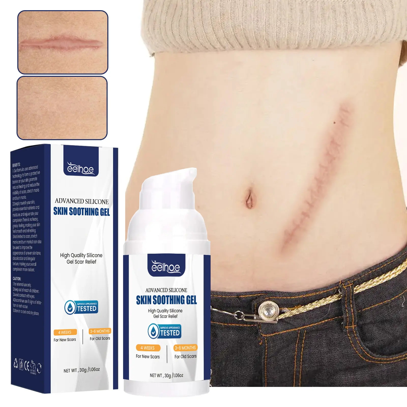EELHOE Scar Repair Gel — Relieves scars after childbirth and surgery; scar care gel