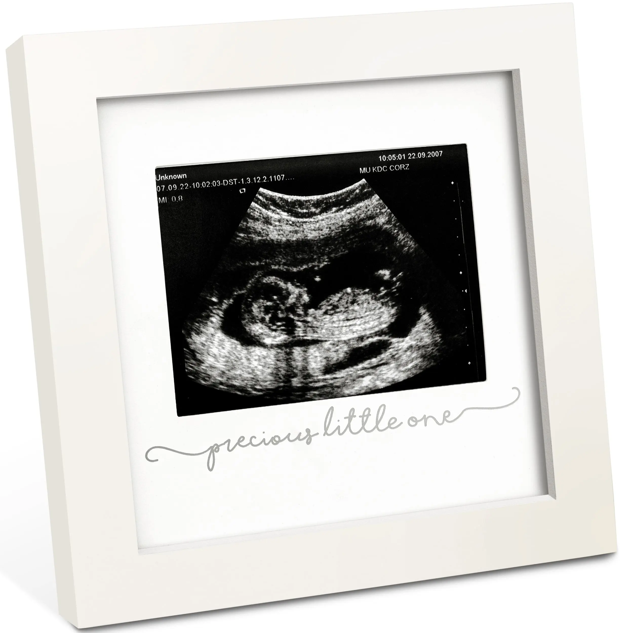 KeaBabies Baby Sonogram Picture Frame - Modern Ultrasound Picture Frames for Mom to Be, First Pregnancy Gifts for Expecting Mom & First Time Dad, Baby Gender Reveal Gifts