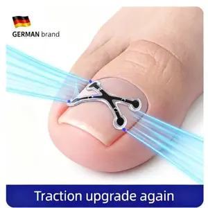 New Upgrade Nitinol Ingrown Toenail Corrector at Home Curved Toenail Straightener  Cutics Manicure Kit with Quick-Stick Strips for Easy Use and Hygiene nail