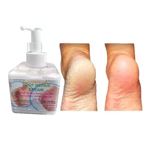 FOOT REPAIR CREAM-Cream for Dry Cracked Feet, Athletes Foot, Nail Fungus, Jock Itch, Ringworm, Cracked Heels and Itchy Skin – Pain Relieving Foot Cream