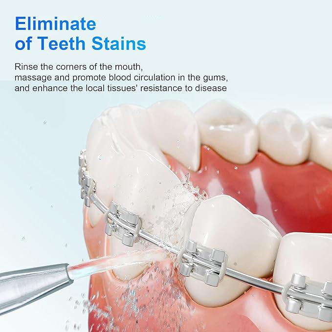 Wireless Water Flosser Oral Irrigator  Flosser  Comes with 4 nozzles IPX7 waterproof rating  ideal for orthodontic treatment with braces and daily oral care