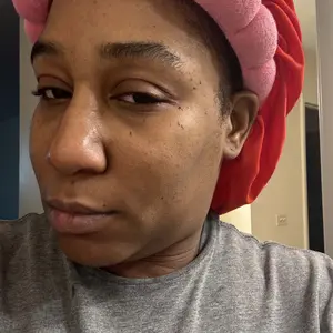 Product Review of [Dr.Melaxin Official] Peel Shot Glow Rice Ampoule Duo - Serums for Brightening, Exfoliating, and Moisturizing - Suitable for All Skin Types from Q**🏽 N**