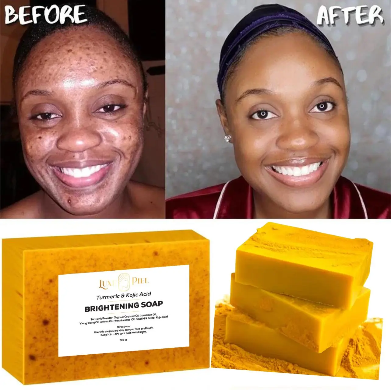 3Pcs Lemon Turmeric & Kojic Acid Brightening Soap