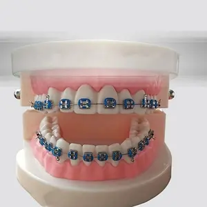 A Pair Fashion Metal Tooth Bracket Decorations, Temporary Colorful Tooth Decoration Kit with Hook, for Upper and Lower Teeth Combination, Fashion Tooth Veneer, with Metal Material, for Tooth Model and Teaching Material