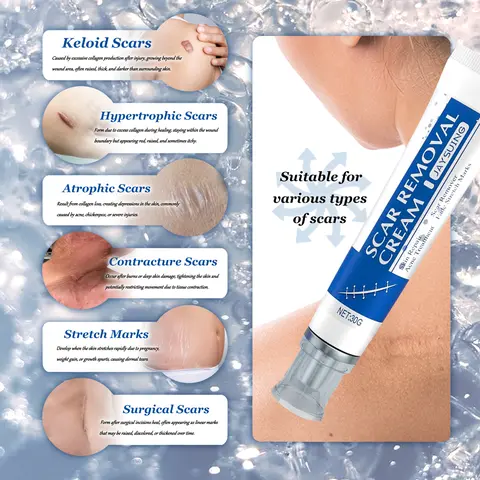 Advanced Silicone Scar Gel - 30g Fast-Absorbing Prop 65 Safe Treatment for Burn & Acne Care, Face & Body Use, Evens Skin Tone, Soothes Skin