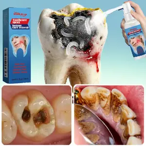 Oral Care Spray – Prevents tooth sensitivity, relieves swollen and inflamed gums, helps with tooth decay, gentle formula for daily use