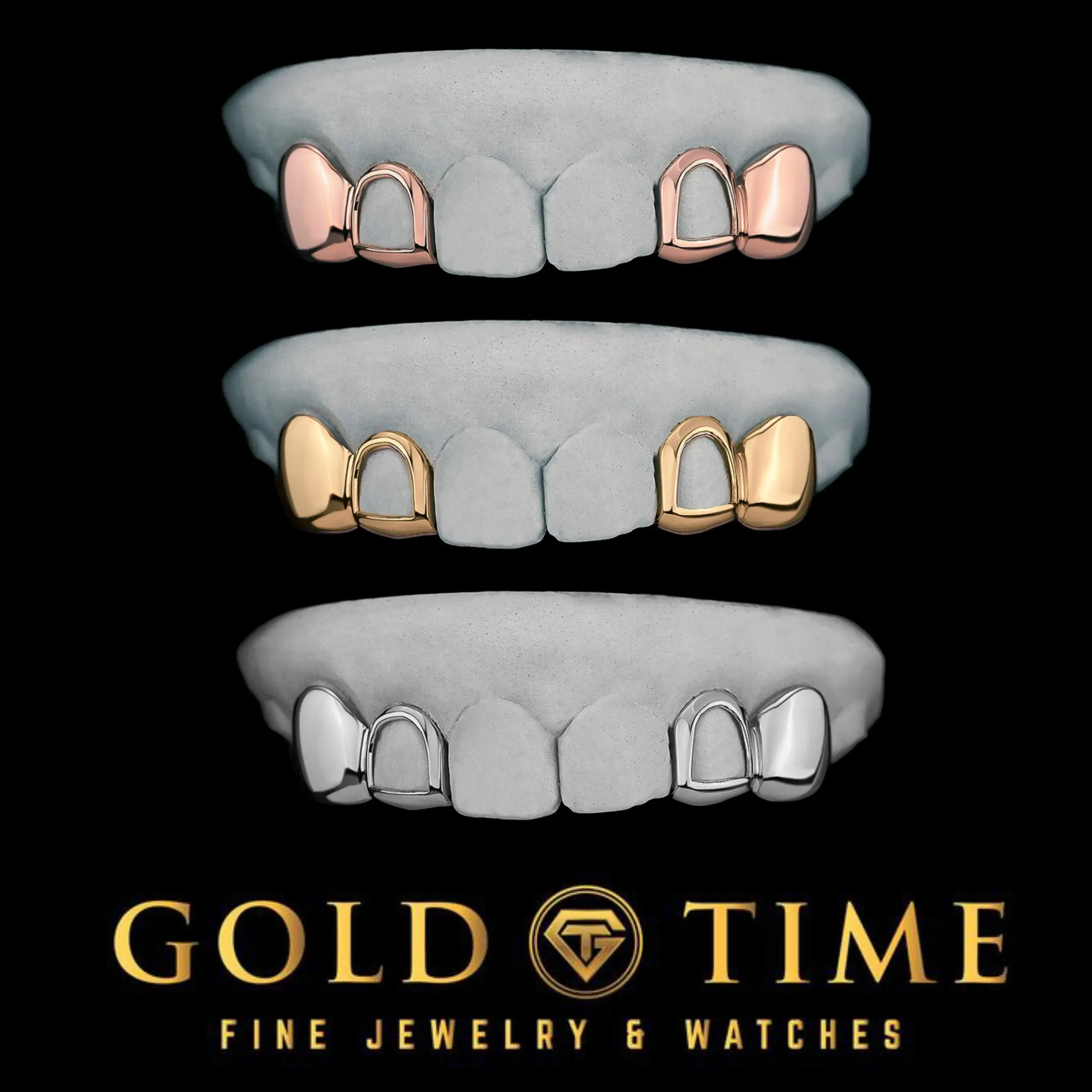 Custom 4-Piece Grillz Set - Open Face Incisors & Solid Canines, 10K/14K Gold or Silver Handmade Grill with Included Impression Kit