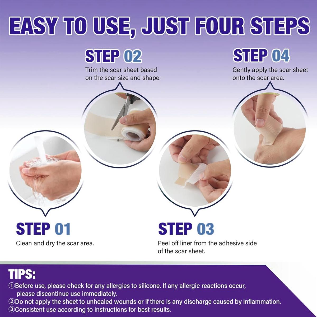 Silicone Scar Sheet Silicone Removal Strips, Silicone Scar Tape For Surgical Scars, Reusagble Effective Removal Silicone Scar Removal Strips Tummy Tuck C- Section For Surgical(1.6"X 59" Roll-1.5M)