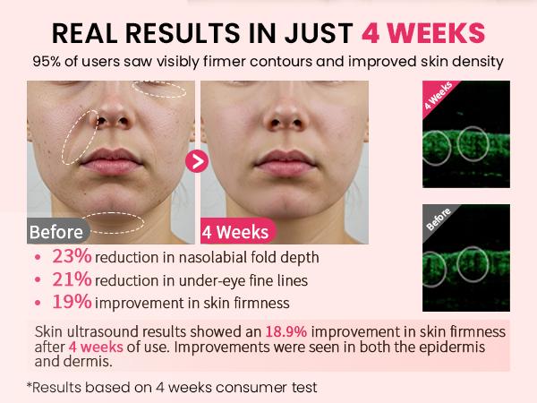 8-in-1 Face Lift Device – LED Light Therapy, Skin Tightening & Anti-Aging Facial Massager