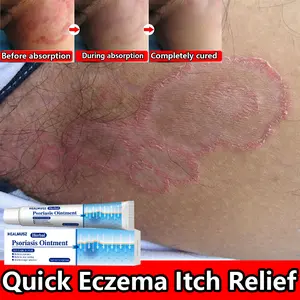 Maximum Power Anti-Fungal Treatment – 7 Days Rapid Healing – Psoriasis, Eczema, Jock Itch, Athlete’s Foot, Ringworm, Herpes, Tinea – Plant-Based, Steroid-Free – Relieve Burning, Redness, Cracks, Stop Itching, Protect Skin Long-Term!