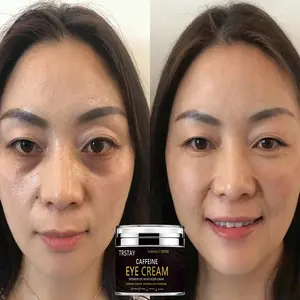 TRSTAY Caffeine Eye Cream effectively moisturizes and nourishes the skin, reducing the appearance of fine lines