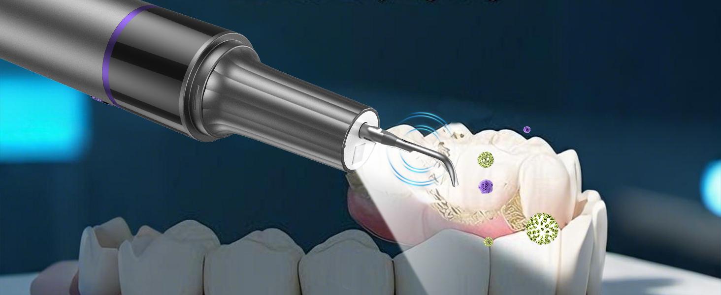 [FONENYCA] Ultrasonic Tooth Cleaner with LED Light andCamera, Four Adjustable Modes, Rechargeable Oral CareDevice. Safely removes plaque, stains, and yellow teethwith four customizable modes. Connects to your phonecompatible with Android and iOS