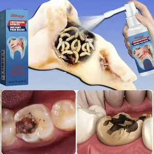 Special analgesic spray for toothache, used to reduce swelling and pain of teeth, eliminate inflammation