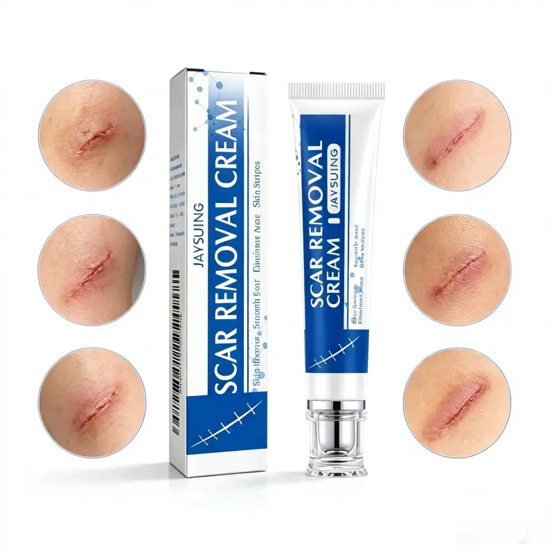 Scar Repair Cream for Surgical Scars, Stretch Marks & Acne - Gentle Healing Treatment to Smooth Skin & Even Complexion - Lightweight Formula, 30g, Scar Cream For Surgical Scars, Beauty Products