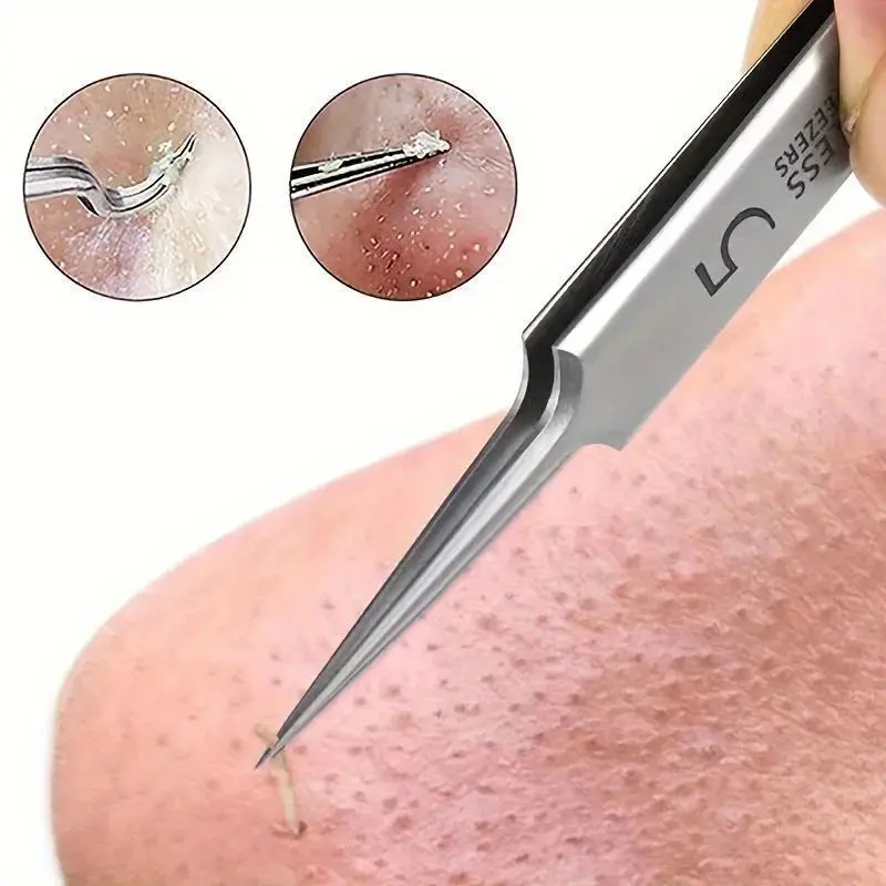 3pcs Professional Facial Blackhead Tweezers, Extractor Kit Pimple Popper Tool, Clip for Whiteheads, Clip, Ingrown Hairs Tweezers, Blackheads Extractor, Stainless Steel