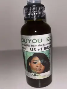 Layouyou Rosemary Infused Scalp & Hair Oil