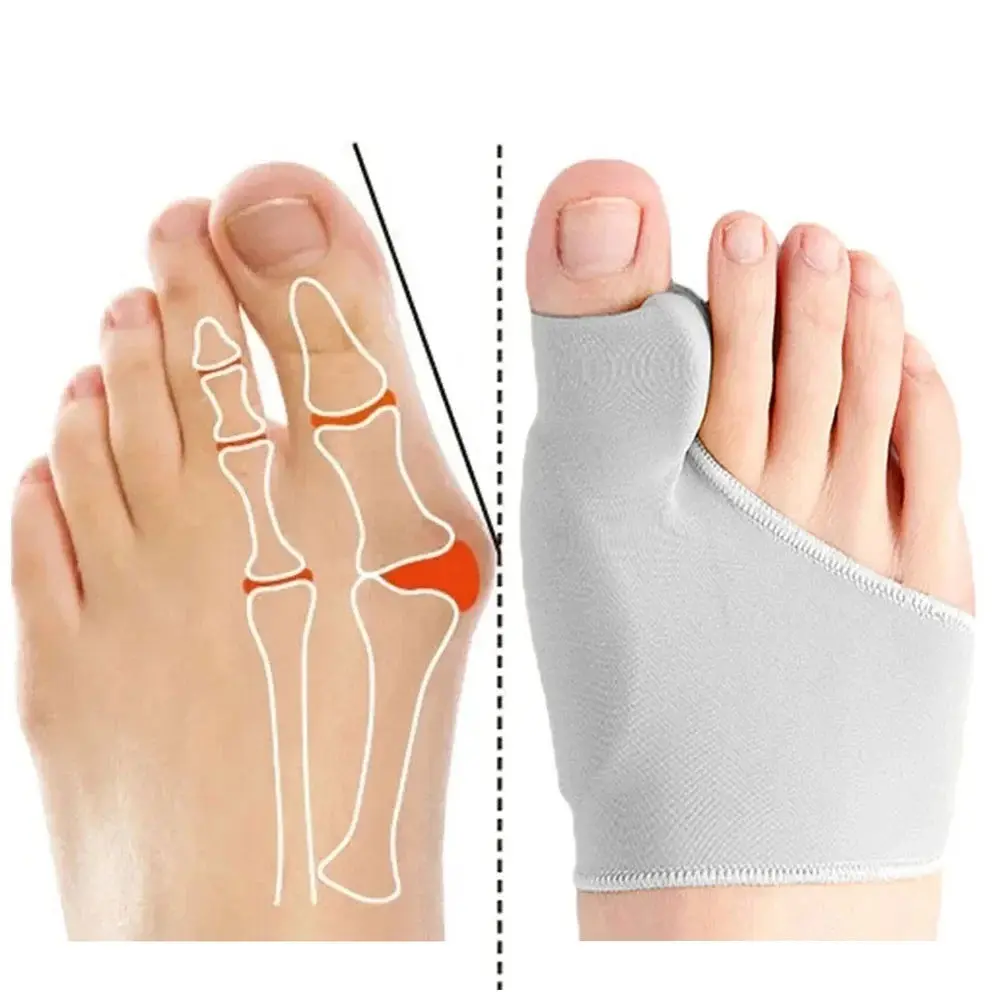 Foot Toe Separator, Bunion Corrector, Hallux Valgus Correction, Orthopedic Orthotics Shoe Insoles, Comfortable Footwear Inserts, Perfect Fit for Daily Wear & Special Occasions, Pedicure Foot Tool, Foot Pain Relief