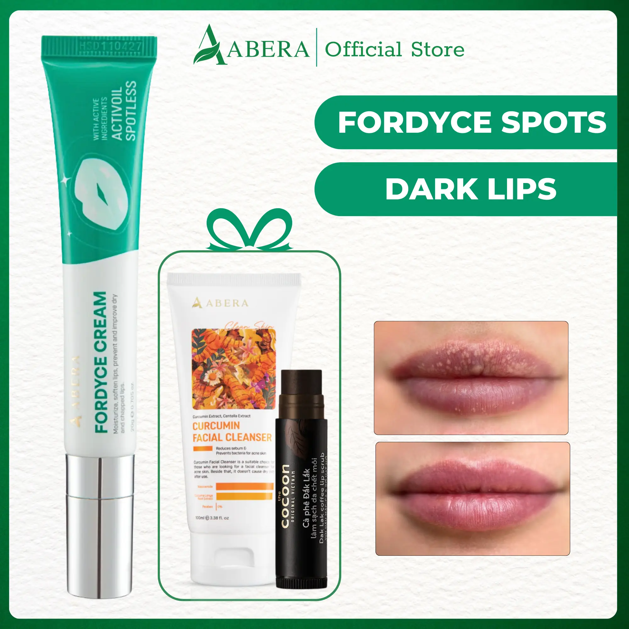 Abera Fordyce Cream – Helps Improve Fordyce Spots, Dark Lips & Moisturizes Lips | Advanced Formula with HPR & Activoil Spotless, 0.7 Oz