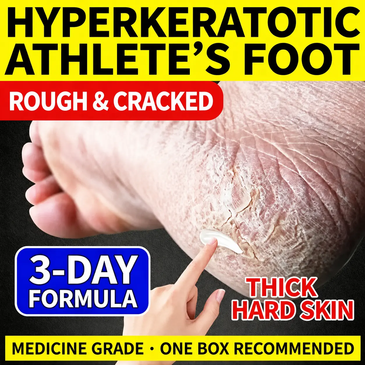 Foot care cream for itching feet, foot odor/foot stench, dry soles, peeling/flaking skin, rough texture; provides a fresh feeling after wearing shoes; suitable for daily use.