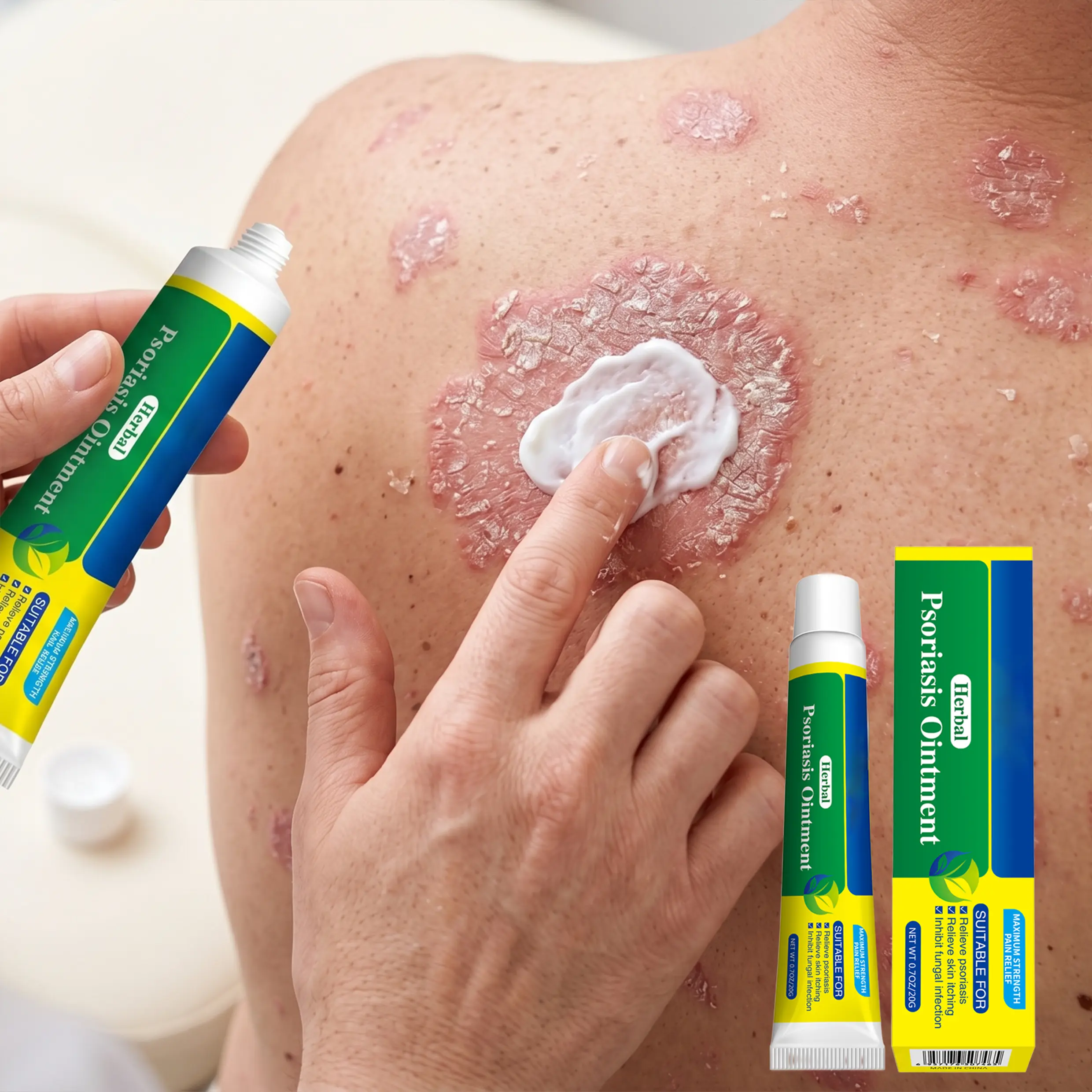 7-Day Sensitive Skin Relief Body Cream Moisturizer - Smooth, Fragrance-Free, Harsh Chemical-Free Hydrating Daily Ointment - Itch Allergy Relief Lotions & Creams, Gentle Lightweight Herbal Formula, 20g Body Care for Psoriasis, Eczema