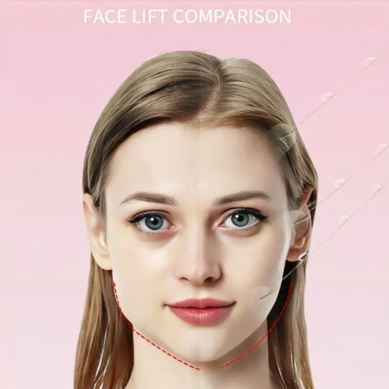 Face lifting patches, 2 boxes / 80 pieces
