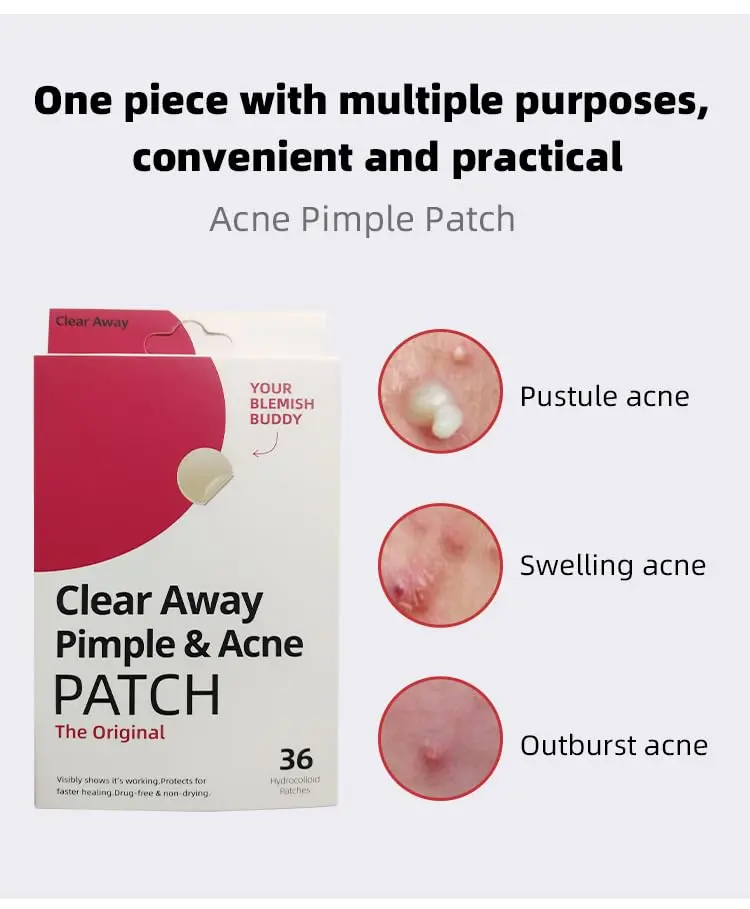 Clear Away Pimple & Acne Patch - Hydrocolloid Acne Pimple Patch for Covering Zits and Blemishes - 36 Original Patches Pack Skincare Gentle Skin Repair