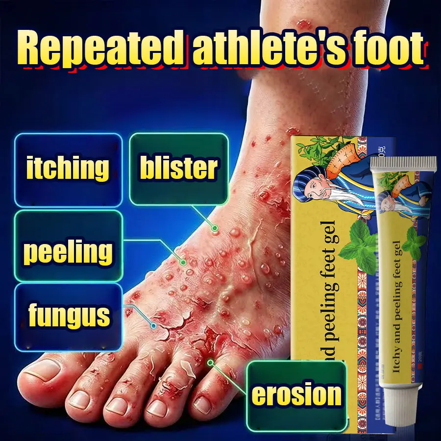 Foot odor cream, antibacterial and anti itch cream, can relieve itching, pain, erosion, and odor caused by fungal infections in the feet. Improve foot skin, relieve burning pain in toe crevices, herbal antibacterial cream.