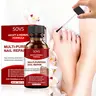 SOVS Unisex Extra Strength Herbal Gel Toenail Fungus Treatment - Triple Action Formula, Smooth Daily Manicure Nail Care, Hydrates Dry Edges, 3x/Day Application, 1 Fl Oz Finger/Toenail Repair Solution