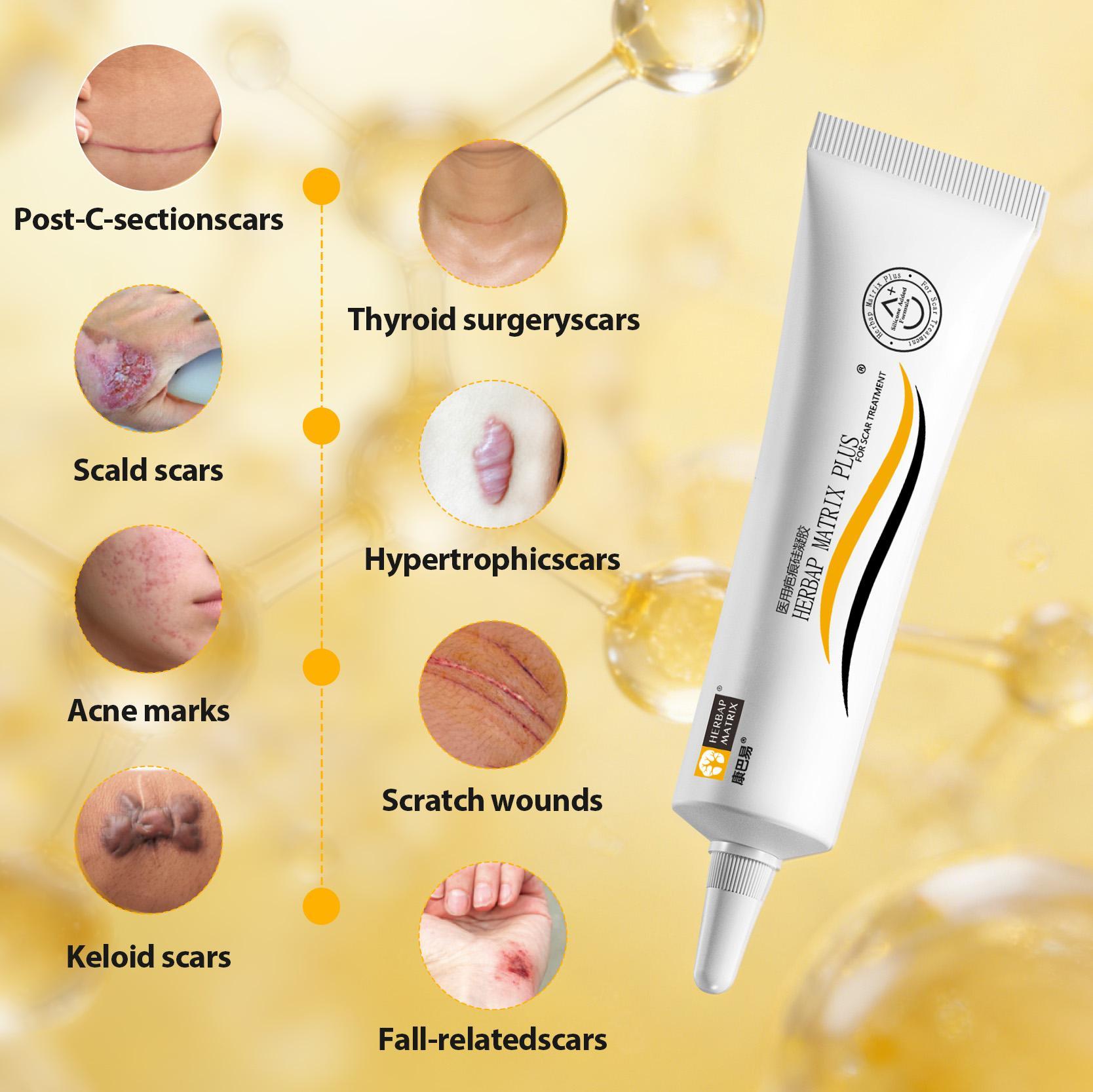 【HERBAP MATRIX Plus】Professional Silicone Scar Treatment for Stretch Marks, C‑Section, Acne Scars & Acne Marks | Helps Prevent Scar Thickening | Face & Body | GMPC ISO 9001 Acne Old Scar Removal Cream for Face & Body | Fades DarkScars Serums, Skin Repair