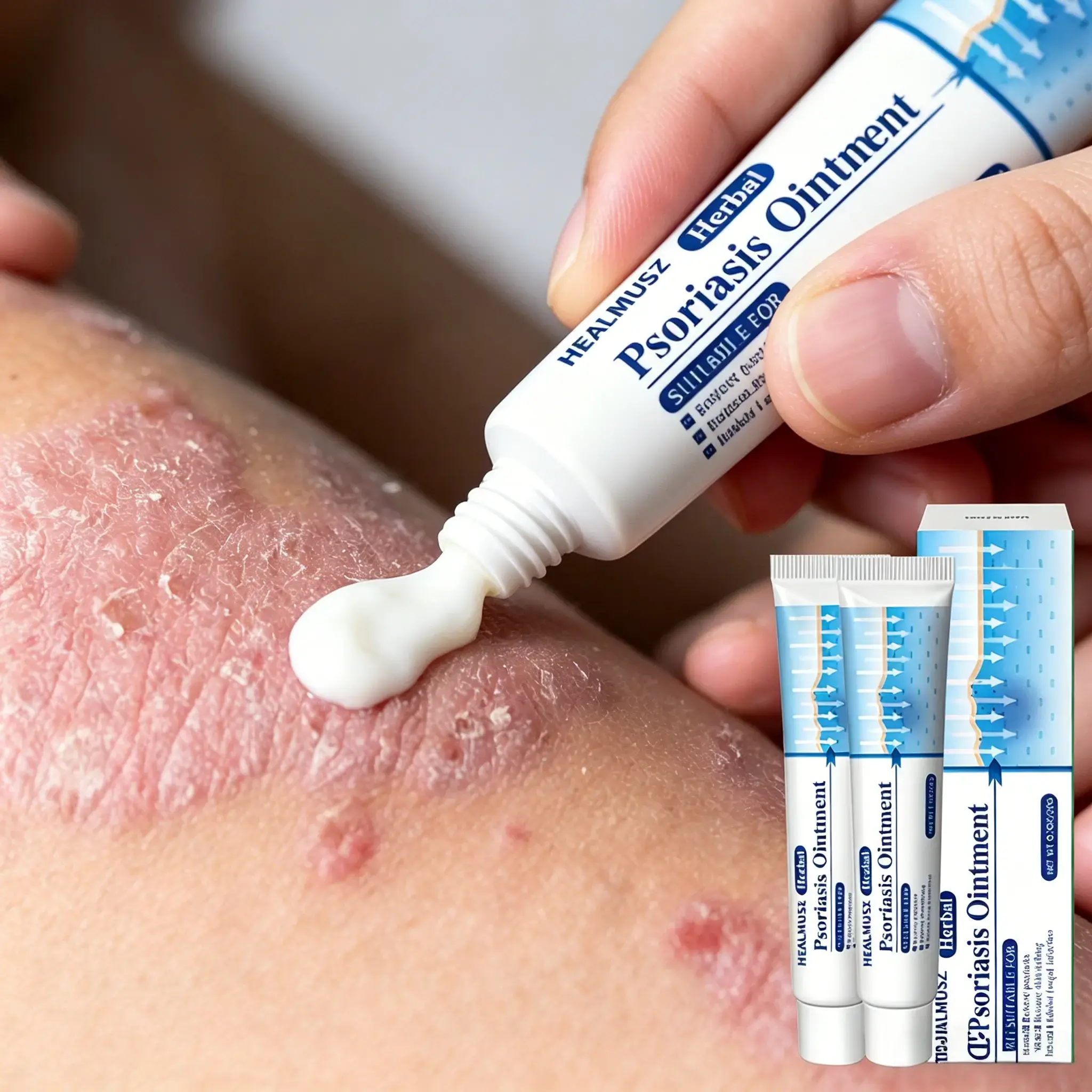 Antifungal & Psoriasis Cream – 100% Natural Plant Formula for Psoriasis, Tinea (Scalp, Body, Groin, Versicolor), Copper Fungus. Fast Relief for Itching, Dryness, Redness. Deep Hydration, Soothing & Non-Recurring– 20g