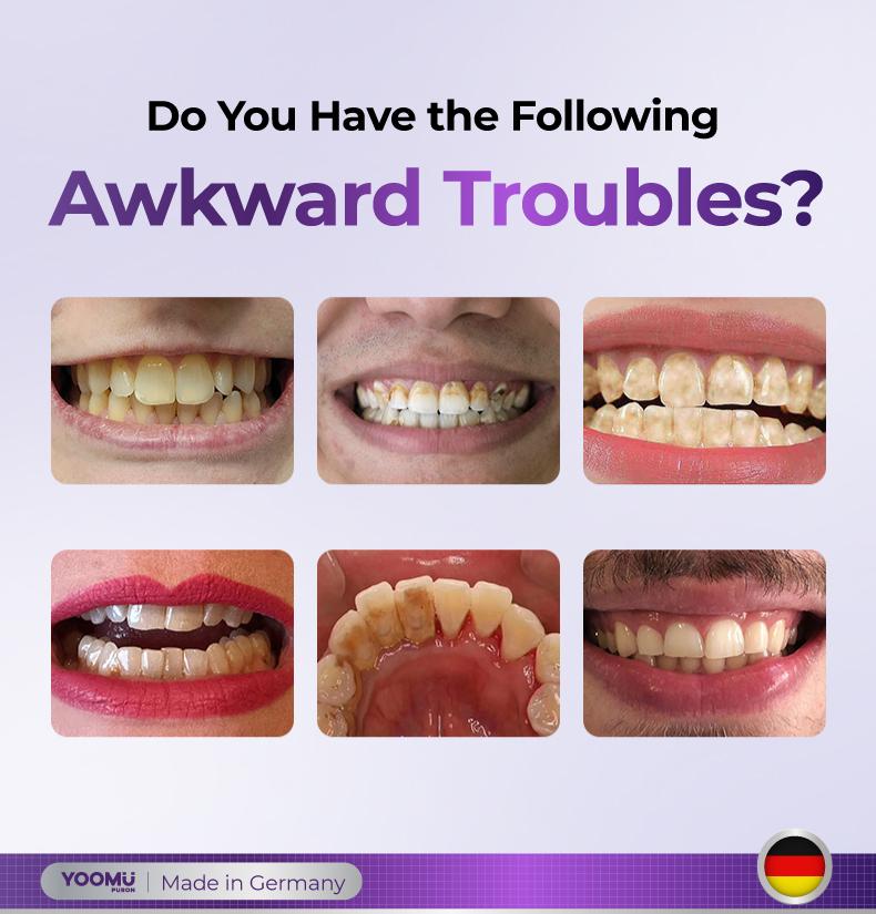 YOOMU 1 Light-Activated Purple Whitening Toothpaste Purple Diamond Brightening, Fresh & Comfortable