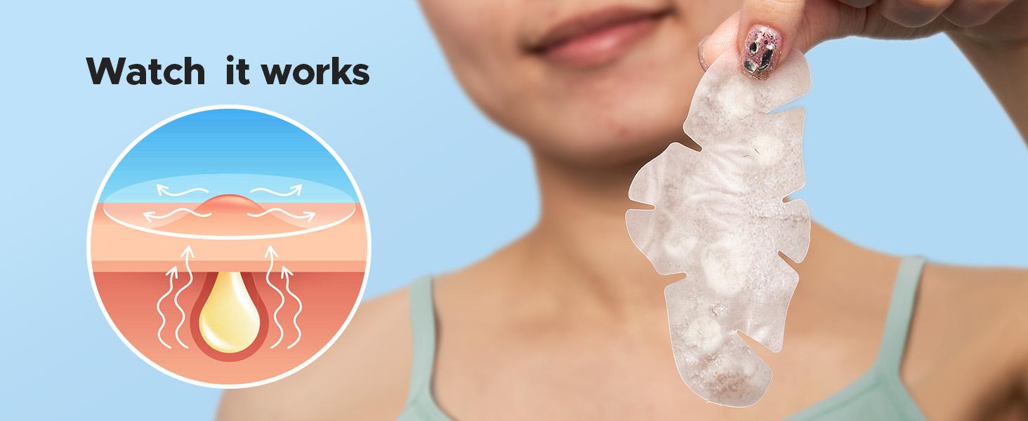 TKTK Hydrocolloid Nose Patches, XL Nose Pore Strips 91 x 48 mm, Large Hydrocolloid Acne Pimple Patches for Face, Cover Zit Blemishes & Absorb Oil (Nose Contoured, Strip, Dots 5 Sizes 112 Count) #mothersdaygift #Summervibes TKTK Hydrocolloid Nose Patches, XL Nose Pore Strips 91 x 48 mm, Large Hydrocolloid Acne Pimple Patches for Face, Cover Zit Blemishes & Absorb Oil (Nose Contoured, Strip, Dots 5 Sizes 112 Count) #mothersdaygift #Summervibes