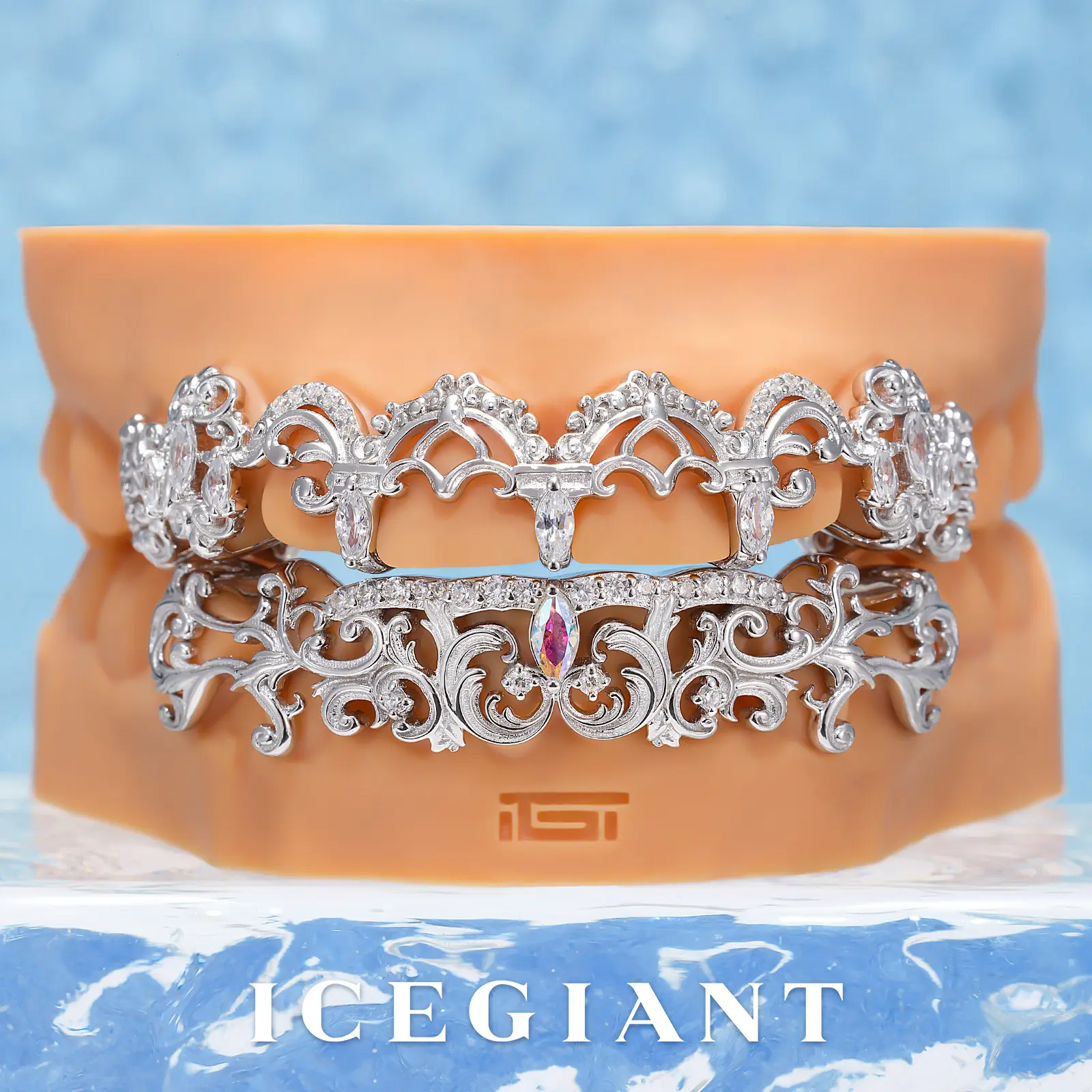 Rainbow Moissanite Baroque Filigree Grillz