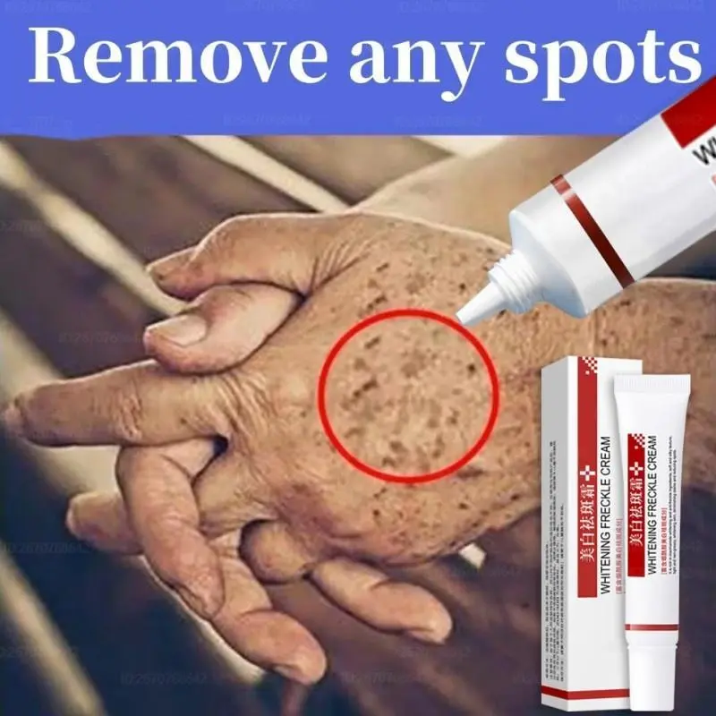 Dull Skin Savior - Brightening Melasma Treatment Cream | Dark Spot Correcting Formula | Even Skin Tone in Weeks