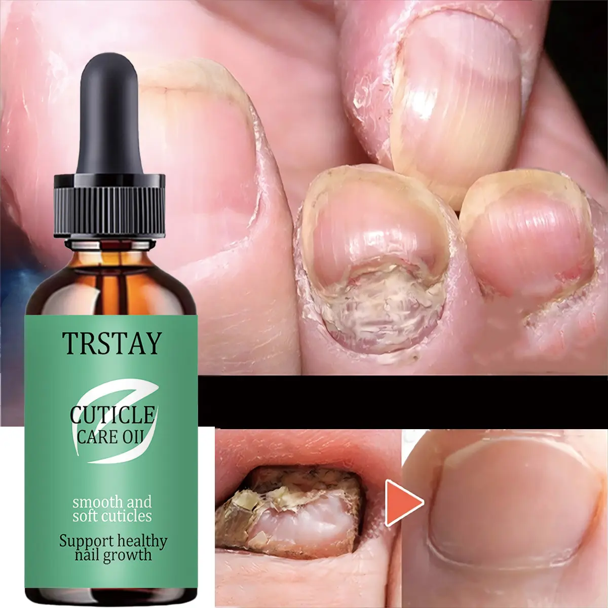 Hydrating Nail Cuticle Treatment Balm Intensive Moisturizer for Dry Brittle Nails Nourishing Care to  Promotes Healthy Nail Growth with Vitamin E