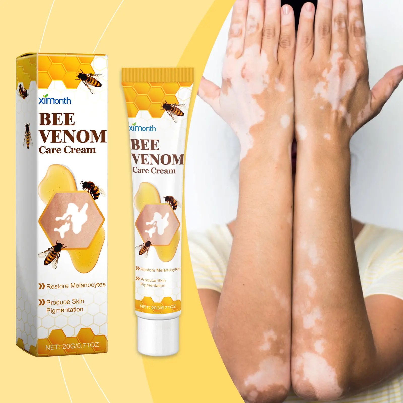 Ximonth Vitiligo Care Cream - Mild Body Care Moisturizer, Topical Treatment for Skin Restore and Pigmentation Improvement