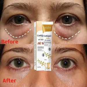 Instant Eye Bag Removal Cream - Firming & Brightening Eye Cream for Dark Circles, Puffiness, and Fine Lines - Skin Hydration & Collagen Boost