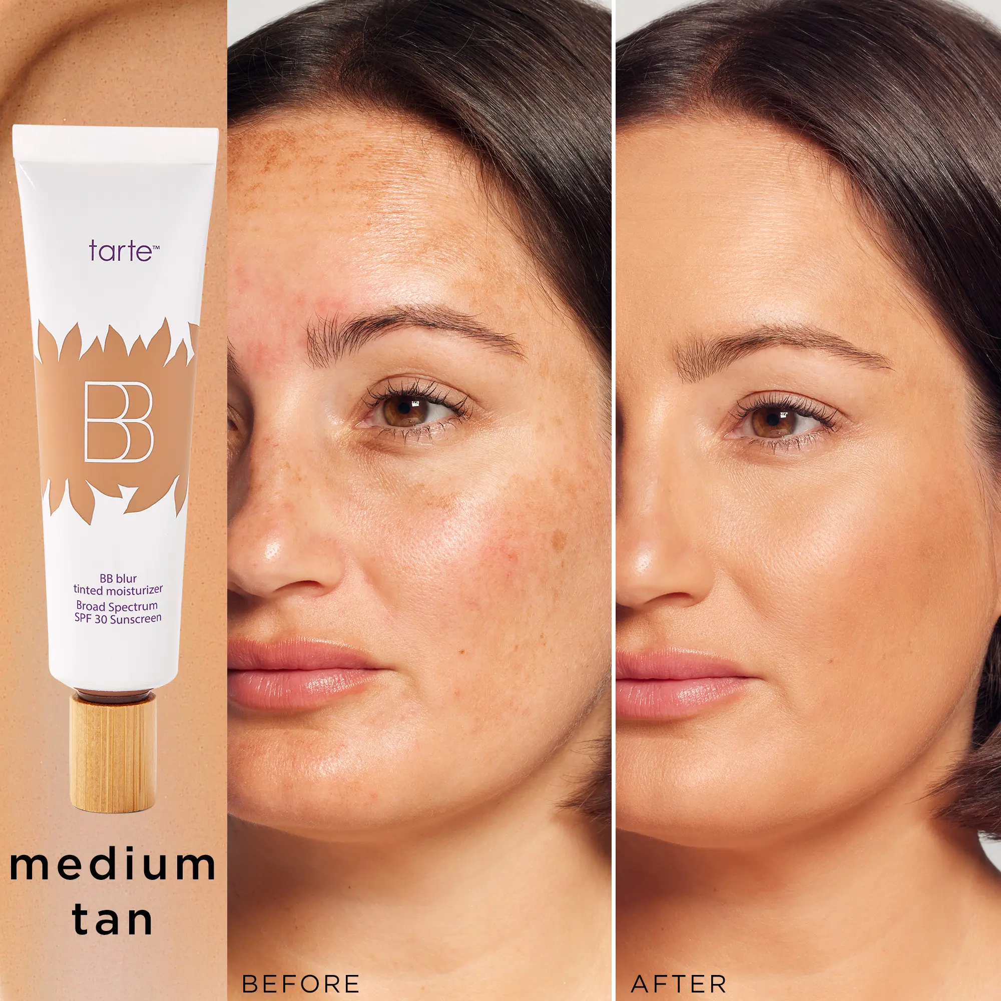 medium-tan (medium to tan skin with a balance o...