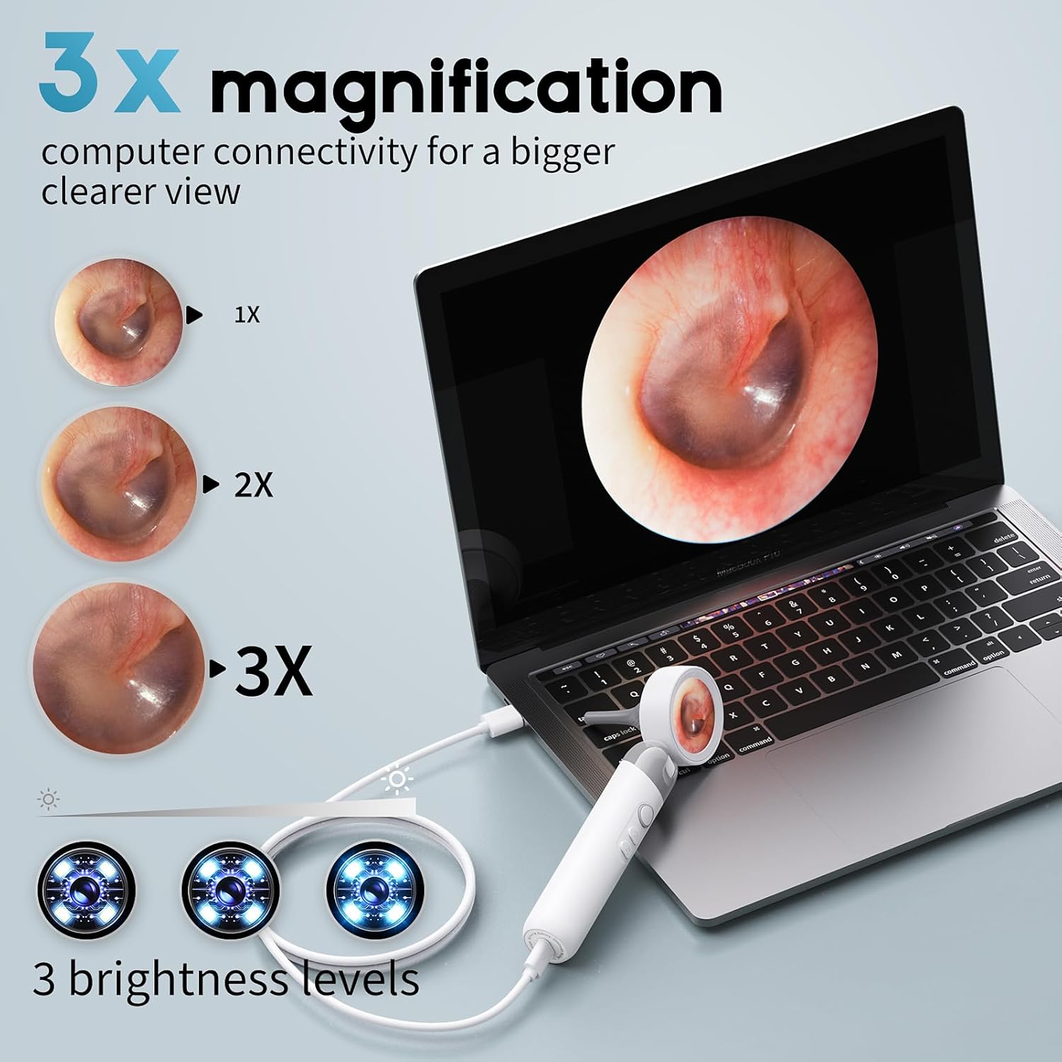 HD Visual Ear Wax Removal Tool, Otoscope Camera Ear Cleaner with LED Light, Safe Ear Cleaning Kit for Adults, Kids, Pets