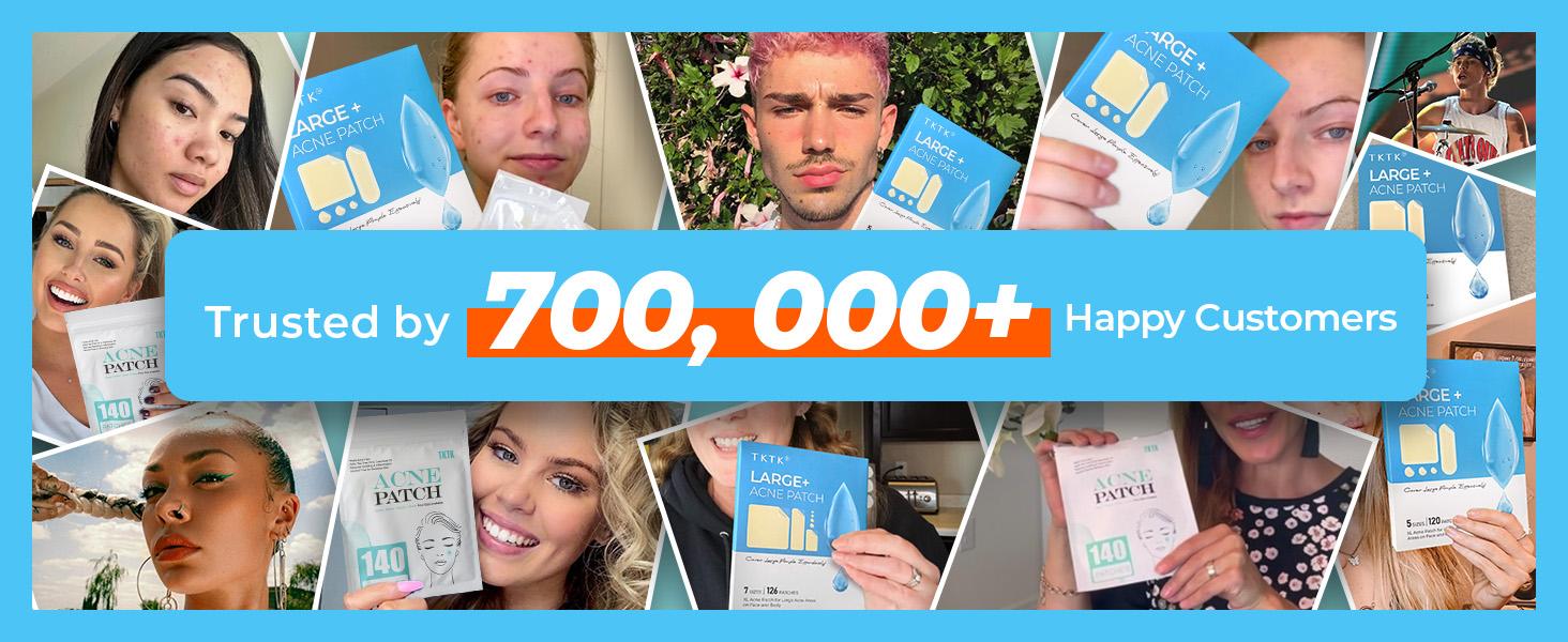 TKTK Hydrocolloid Bandages, 45 x 45 mm Large Pimple Patches for Face, XL Acne Patches for Body, Back, Forehead, Cheek Zit Breakouts, Big Hydrocolloid Patch (Square, Strip, Dot 5 Sizes 120 Count)