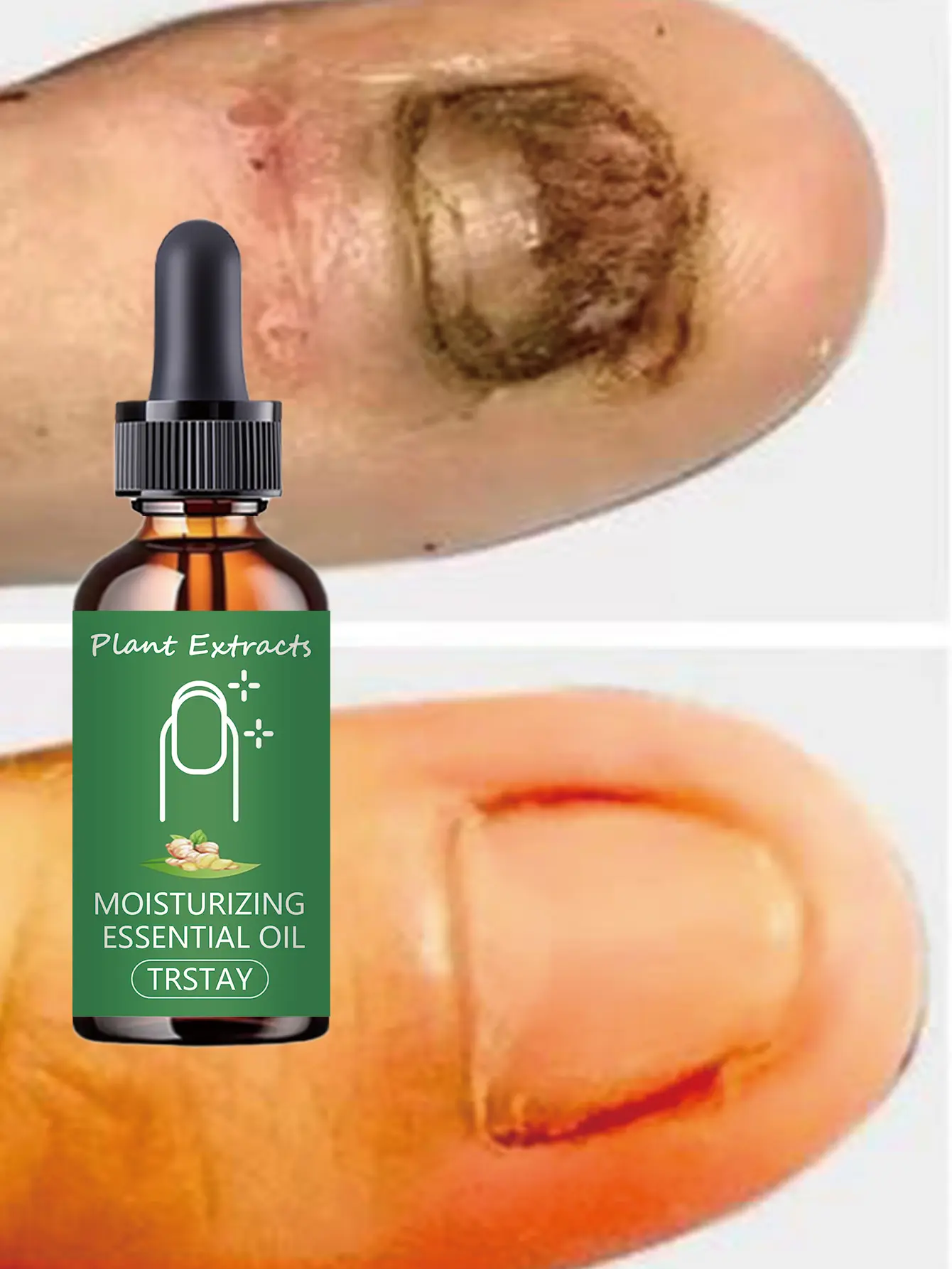50ml Hyaluronic Acid Nail Cuticle Repair Serum, Natural Extracts Liquid Moisturizer - Hydrate Dry Damaged Cuticles, Support Healthy Nail Growth