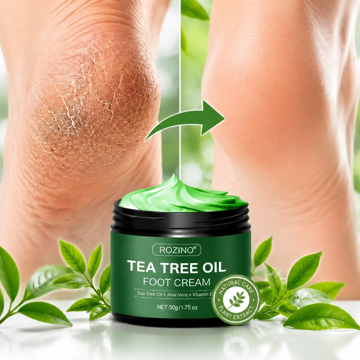 ROZINO Tea Tree Oil Foot Cream, Moisturizing Treatment for Dry Cracked Heels, Rough Feet and Calluses, Multi-use Softening Cream for Hands, Elbows & Knees, 50g with Aloe Vera：