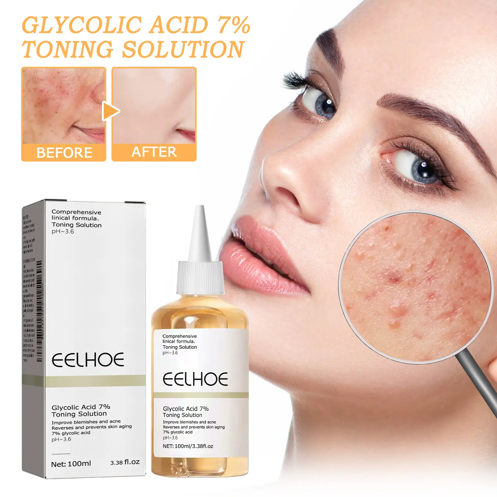 7% Glycolic Acid Exfoliating Toner 100ml, With Aloe Vera,Hydrating & Soothing, Gentle for Daily Skin Care, Ideal Gift